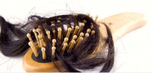 10 Common Causes of Female Hair Loss